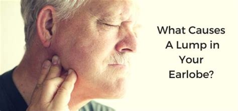 8 Causes And Treatments For Lump In Earlobe Daily Health Cures