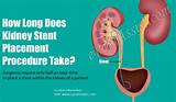 How Do Doctors Test For Kidney Infection Pictures