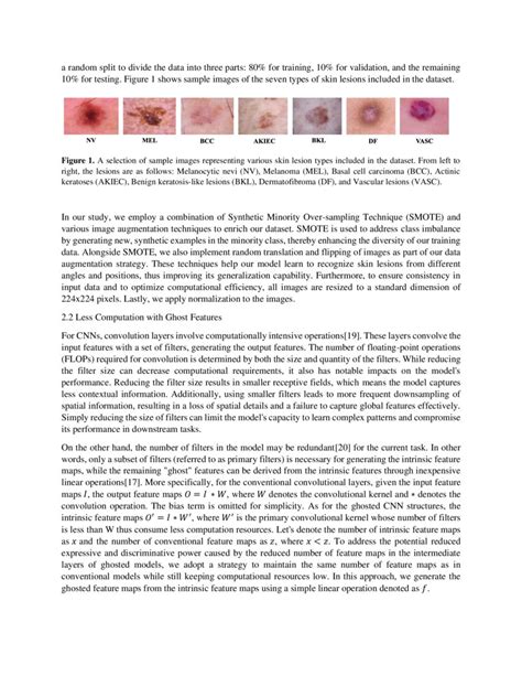 Attention Driven Lightweight Model For Pigmented Skin Lesion Detection