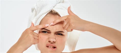 Blind Pimples 101 Meaning Identification Causes Prevention The