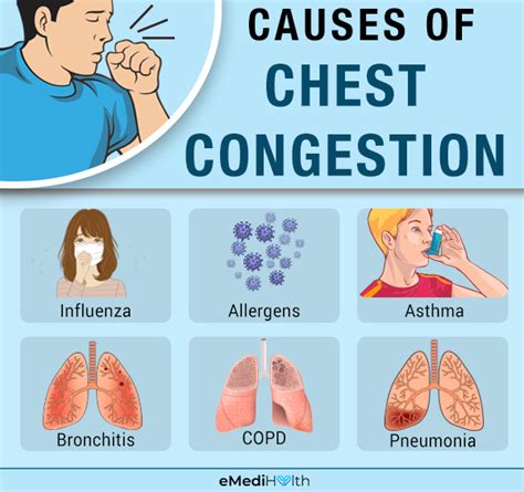 Chest Congestion Causes Symptoms And Treatments