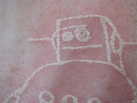 Laser Tattoo 7 Steps With Pictures Instructables
