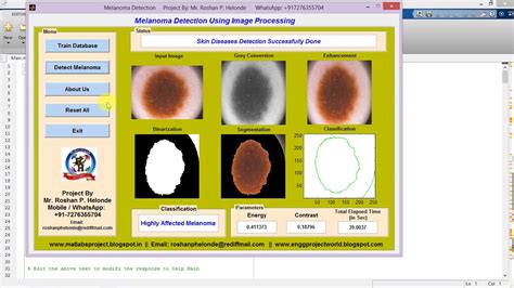 Melanoma Detection Using Image Processing Full Matlab Project Code
