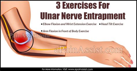 3 Exercises For Ulnar Nerve Entrapment Ulnar Nerve Entrapment Nerve