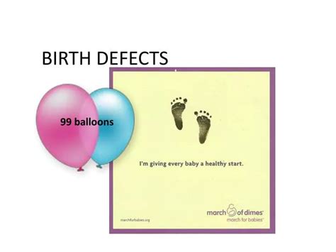 Ppt Birth Defects Powerpoint Presentation Free Download Id2926843