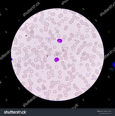 Lymphocyte Blood Smear Under Microscopy Stock Photo 2094112180