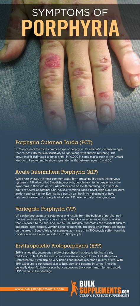 Porphyria Symptoms Causes And Treatments