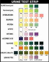 Images of Urinalysis Normal Ranges
