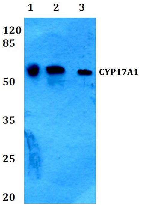 Cyp17a1 Polyclonal Antibody Pa5 86415