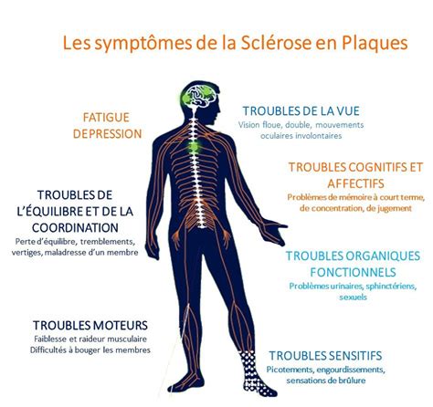 Les Symptomes Et Diagnostics De La Sclérose En Plaques Sep Icm