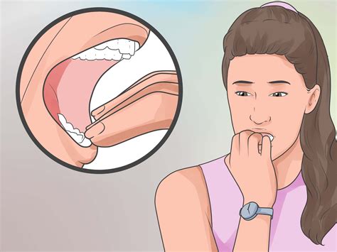 Onion can cause anemia in cats, period, and a cat that is having eating problems can suffer more. How to Pick Your Teeth Without a Toothpick: 6 Steps