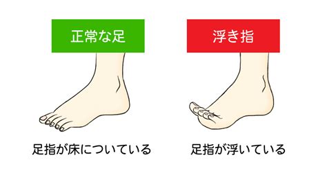 Botsuraku youtei nanode, kajishokunin wo mezasu manga: 足が綺麗な人にふくらはぎが太い人はいない？ふくらはぎが ...