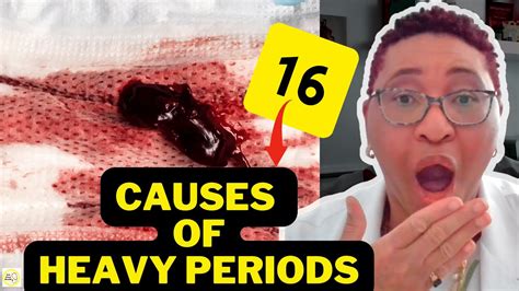 🤔heavy Flow During Periods Means 16 Causes Youtube