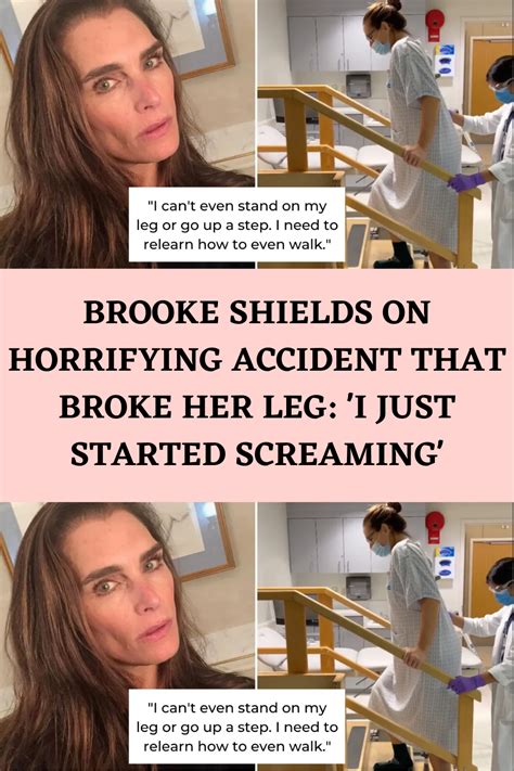 Brooke Shields On Horrifying Accident That Broke Her Leg I Just Started Screaming Brooke