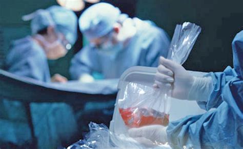 Lei De Transplante De órgãos Vai Ser Aprovada Em 2020 Lei De