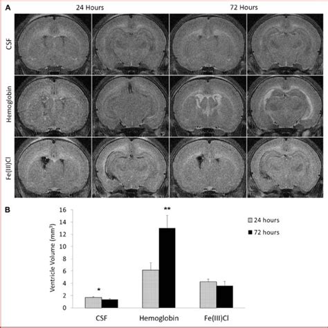 Periventricular Ho 1 And Iron After Intraventricular Injection Of