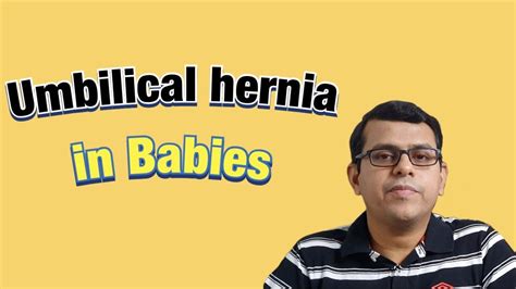 Umbilical Hernia In Babies Youtube