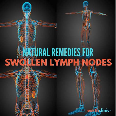 How To Treat Swollen Lymph Nodes Using Natural Remedies Swollen Lymph