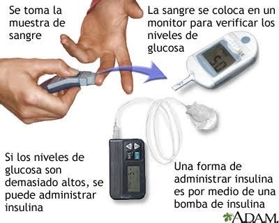 Examen de glucosa MedlinePlus enciclopedia médica illustración