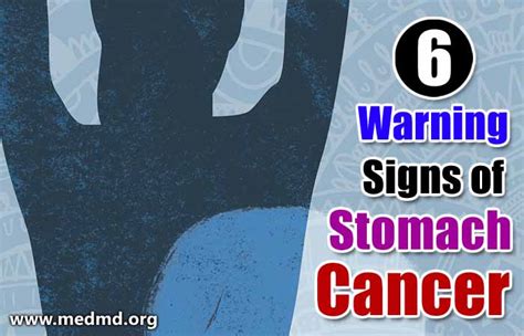 Early Warning Signs Stomach Cancer