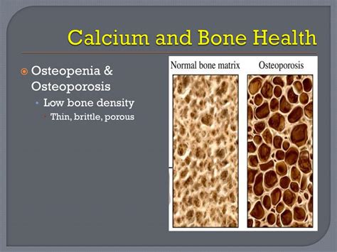 Ppt Calcium Powerpoint Presentation Free Download Id3176614