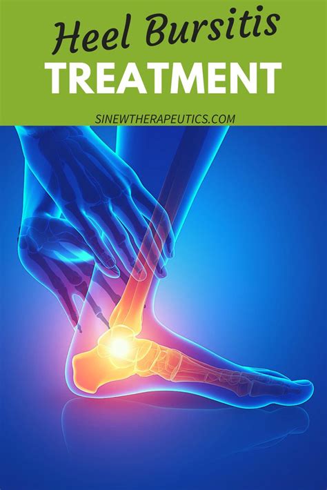 93 Best Heel Bursitis Images On Pinterest Heel Pain Sports Medicine