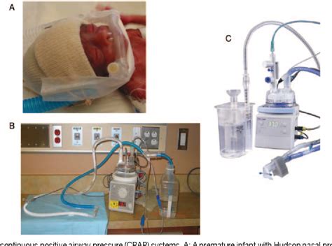 Figure 10 From Nasal Continuous Positive Airway Pressure Cpap For The