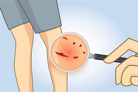 Human Leg Clip Art Vector Images And Illustrations Istock