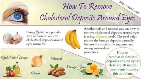 10 Natural Ways On How To Remove Cholesterol Deposits Around Eyes