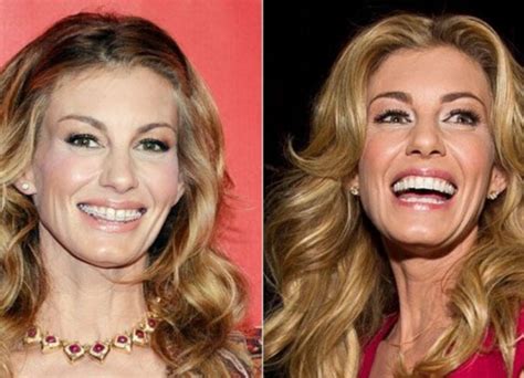 Faith Hill Plastic Surgery Did Faith Get A Nose Job