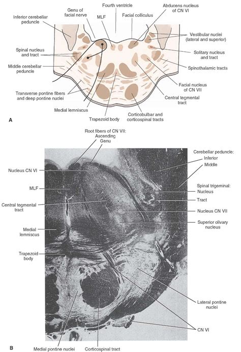 Brainstem Ii Pons And Cerebellum Part 2