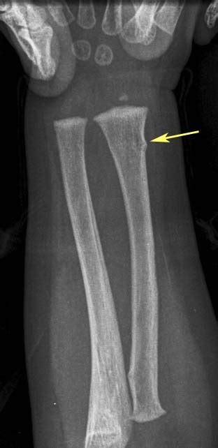 17 Best Images About Radiology On Pinterest Medical