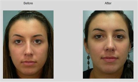Williams Center Plastic Surgery Specialists 18 Photos And 13 Reviews