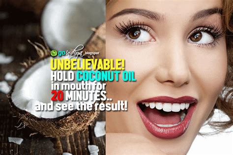 Unbelievable Hold Coconut Oil In Mouth For 20 Minutes For Whiter Teeth