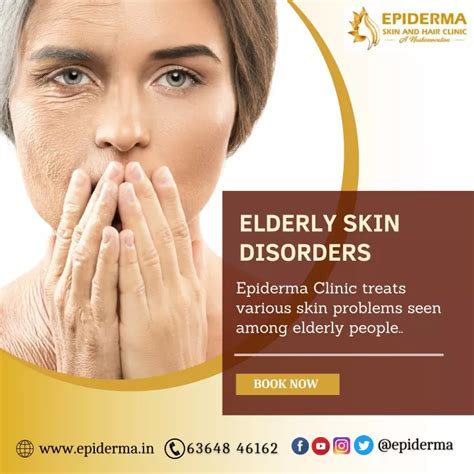 Ppt Elderly Skin Disorders Best Dermatology Centre In Jayanagar