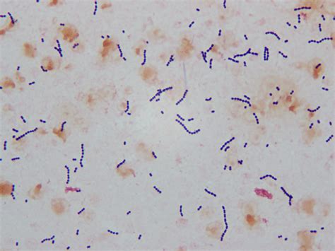 Streptococcus Pyogenes Gram Stain