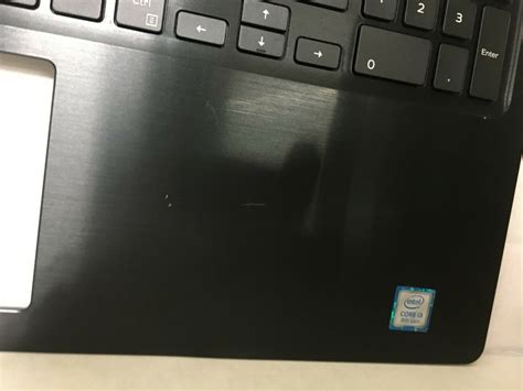 Genuine Dell Inspiron 15 5570 5575 Palmrest Backlit Us Keyboard