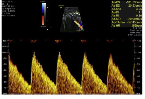 Examination Of The Fetal Cardiovascular System Semantic Scholar