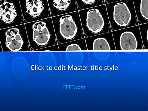 Ct Scan Ppt Free Download Captions Hunter