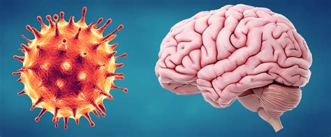 Infecciones Virales Como El Covid 19 Y Sus Efectos En El Cerebro Dacer