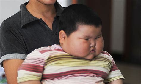 Obese Baby In China Parents Desperate Plea For Doctors To Help Their