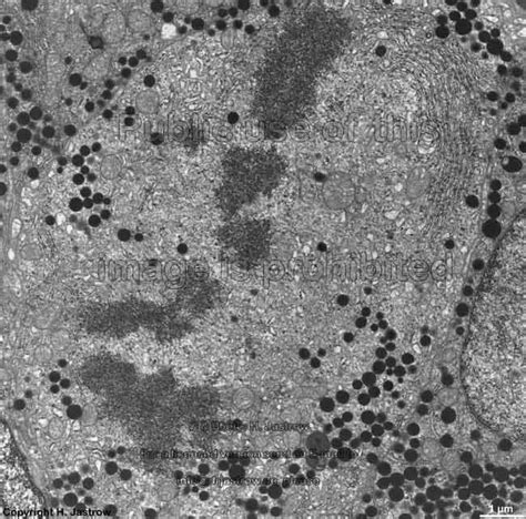 Chromosomes Dr Jastrow S Electron Microscopic Atlas