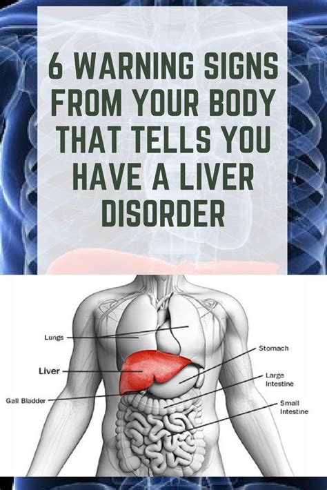 6 Warning Signs From Your Body That Might Indicate You Have A Liver
