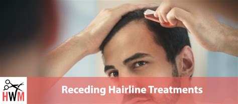 It separates the good barbers you'll tip that extra $5 to from the ones who you walk past in the streets as but, if you look at the men in your family you can get a good glimpse of what your hairline will look like. Best Receding Hairline Treatments to Regrow Your Hairline ...