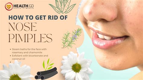 How To Get Rid Of Nose Pimples 4 Natural Remedies Healthgd