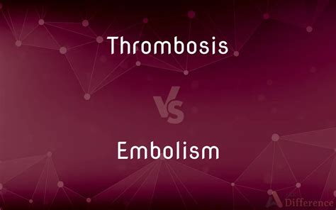 Thrombosis Vs Embolism — Whats The Difference