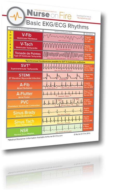 Ekg Ecg Cheat Sheet 11 Basic Rhythms Nurses Need To Know Download