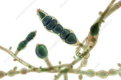 Microsporum Audouinii Fungus Illustration Stock Image F0367224