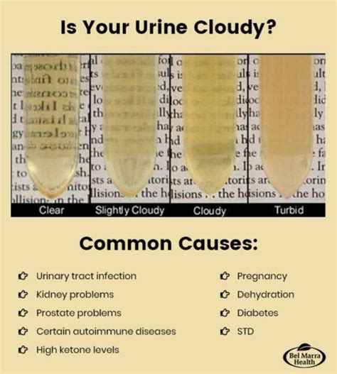 Understanding The Importance Of Urine Color Urology Specialists Of Cloudy Urine Symptoms