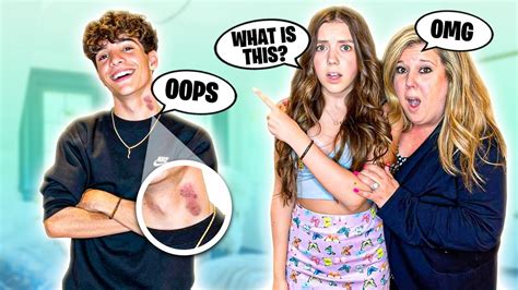 Hickey Prank On Girlfriend To See How She Reacts Freaks Out 🔥💋 I Nick Bencivengo Youtube